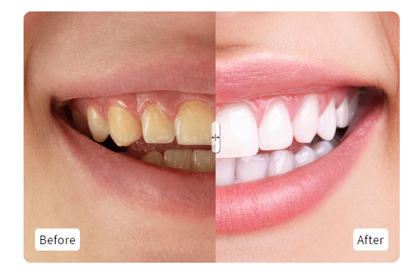 Before and after image slider
